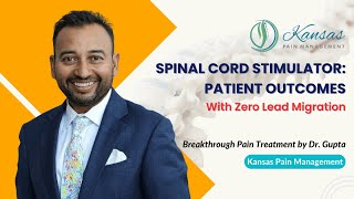 Patient Outcomes: Insights from Dr. Gupta on Spinal Cord Stimulator & Neuromodulation