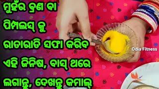 ପୁଅ ହୁଅନ୍ତୁ ବା ଝିଅ ଯଦି ଆପଣଙ୍କ ମୁହଁରେ ବ୍ରଣ ବା ପିମ୍ପଲସ୍ ହେଉଛି, ତେବେ ରାତିରେ ଲଗାନ୍ତୁ ଏହି ଗୋଟିଏ ଜିନିଷ