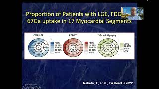 Dr Leslie T. Cooper Jr.  Sarcoid video March 12, 2023