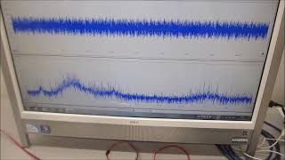 メガヘルツ超音波の表面弾性波制御技術－－超音波の非線形制御システムを開発する技術ーー（超音波システム研究所）