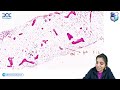 🔬 pathology rapid revision with dr. vandana puri fmge jan 2025 📚💯