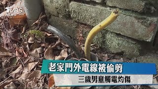 老家門外電線被偷剪  三歲男童觸電灼傷