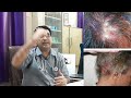 lichen planus skin disease के कारण लक्षण और 100% इलाज by dr yogendra bola