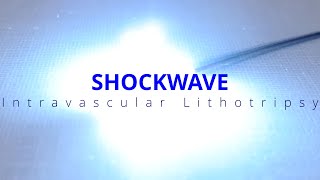 How to Prep and Use Shockwave Intravascular Lithotripsy
