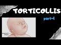 Torticollis : Part -1 [World of Anatomy]