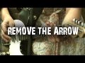 We All Want To | Remove The Arrow