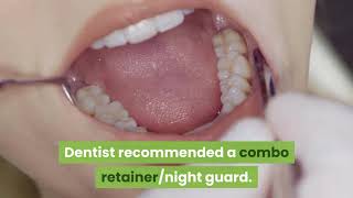 Dentist recommended a combo retainer night guard does chomper custom have hard edges?