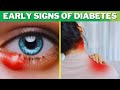 11 Early Signs Symptoms Of Diabetes You Need To Look Out For