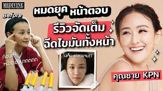 คลิปจัดเต็ม! รีวิวฉีดไขมันสเต็มเซลล์ทั่วหน้า! คุณซายKPN เพิ่มความสวยทั้งที ต้องดูให้ดีจะได้ไม่มีพลาด