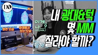 안면윤곽 돌직구 리얼상담! 얼굴뼈는 몇 mm 깎느냐가 중요한게 아니다? [디상일 Ep.5-1]