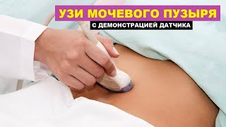 УЗИ мочевого пузыря. Порядок выполнения.