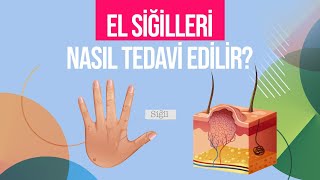 El Siğilleri Genital Bölgeye Bulaşır Mı? El Siğilleri Nasıl Tedavi Edilir?