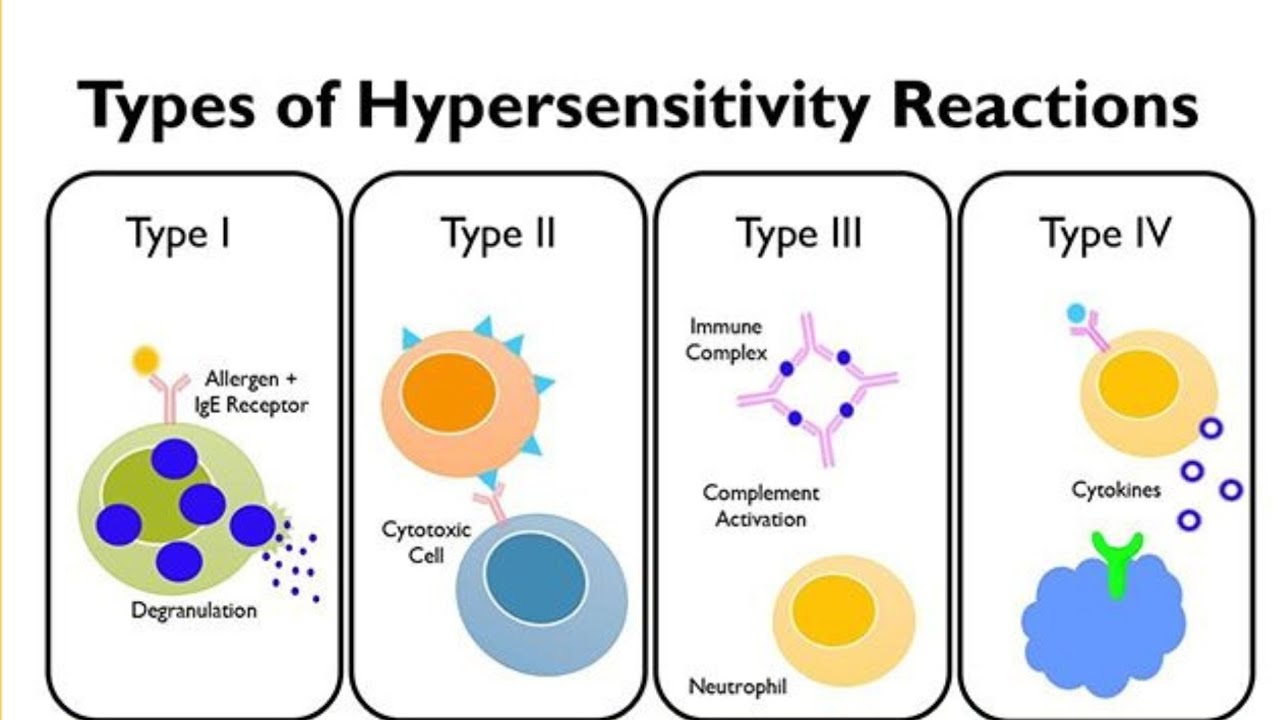 Hypersensitivity Reactions: Types 1 To 4 Explained With Examples - YouTube