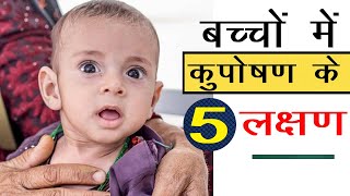 बच्चे में कुपोषण के 5 बड़े कारण , लखन और इलाज  | 5 symptoms of malnutrition in child