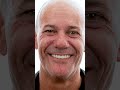 rob s remarkable smile transformation before and after with all on 4