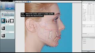 [simple tutorial 04] Simulation \u0026 Consultation