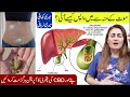 How To Remove Gallbladder Stone Without Surgery? Gallbladder Stones Treatment Without Operation?