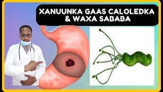 CUDURKA GAAS CALOOLEDKA PUPTIC ULCER DISEASE HELOCOBACTER PYLORIC BATERIYADA CALOOSHA \u0026 NUCYADED