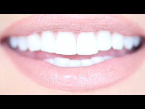 How to Get Really White Teeth For Cheap | Kandee Johnson How to Get Really White Teeth For Cheap | Kandee Johnson