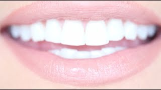 How to Get Really White Teeth For Cheap | Kandee Johnson