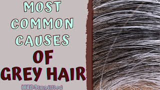 MOST COMMON CAUSES OF GREY HAIR