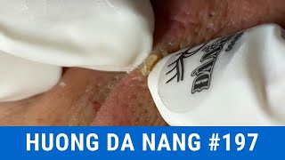 #197 | Huong Da Nang