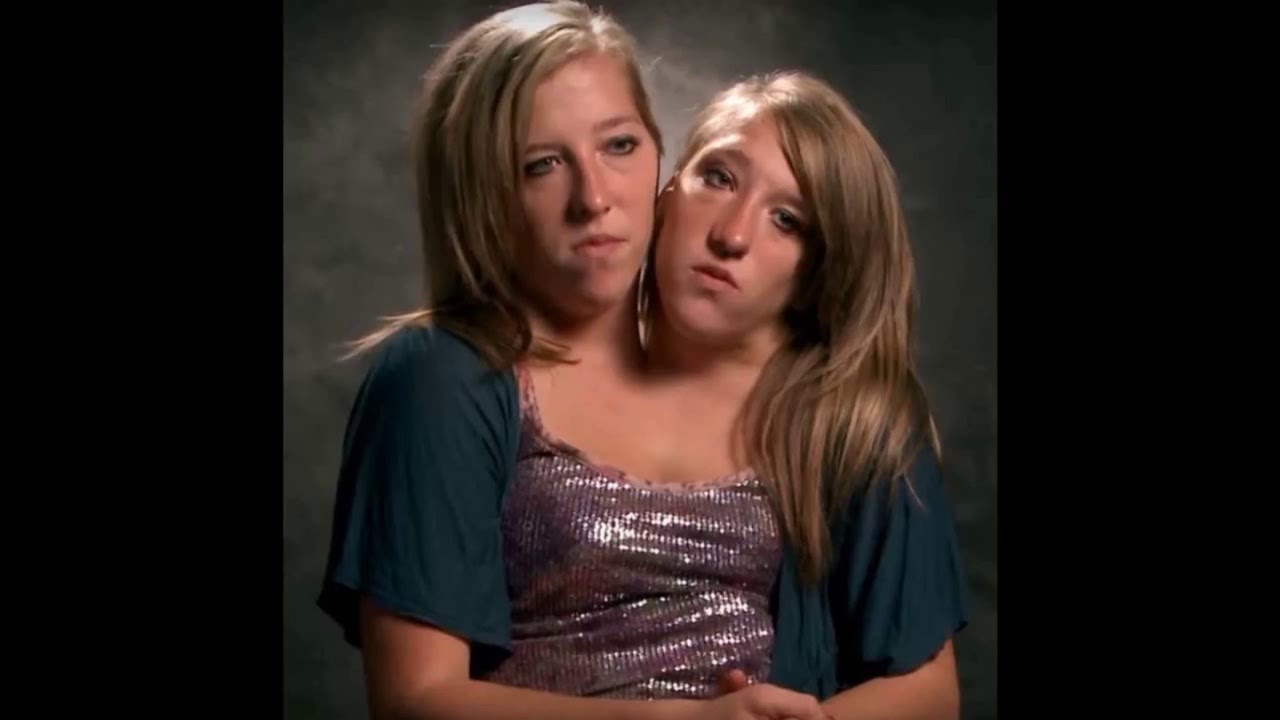 Famous Conjoined Twins - Abby And Brittany Hensel Are Now Teachers ...