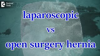 Why Laparoscopic surgery is better than Open Hernia Surgery? - Dr. Nanda Rajaneesh