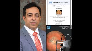 Multimodal Retinal Imaging using Mirante SLO | #mirantemagic | Wide field Imaging | Dr Manish Nagpal