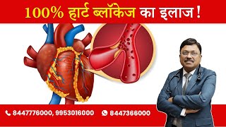 Treatment of 100% blockage | By Dr. Bimal Chhajer | Saaol