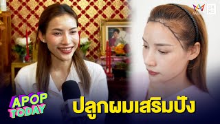 “นุช วิลาวัลย์” ไม่หยุดสวย ขอลงทุนปลูกผม เสริมความปัง | Apop Today