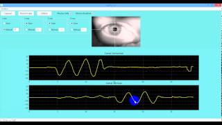 Pupil detection - Python and OpenCV - Videonistagmography System