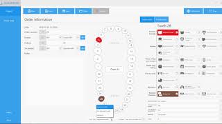 Designating a Prescription with Shining 3d DS-EX Scanner