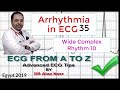 ECG from A to Z, intermediate level, Arrhythmia 35, Dr Alaa Nasr, 2019