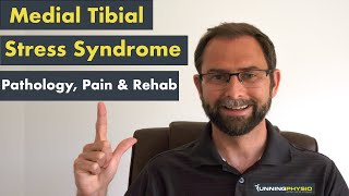 Medial Tibial Stress Syndrome (MTSS) - FB live