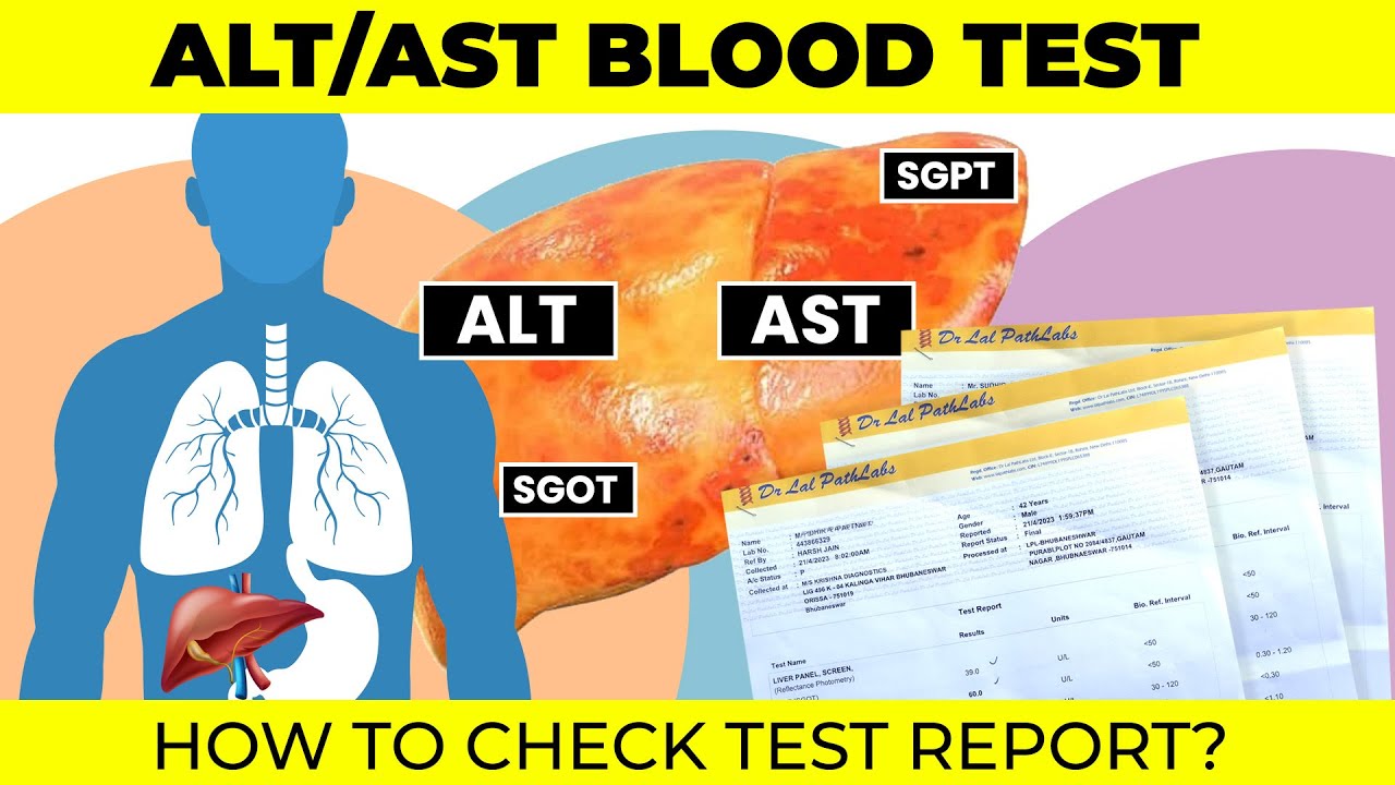 ALT AST Blood Test | Liver Function Test | #hepatitis - YouTube