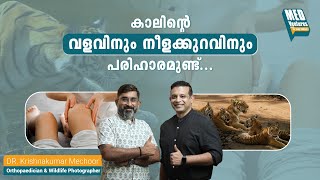 MedVentures | Episode-10 | കാലിൻ്റെ വളവിനും നീളക്കുറവിനും പരിഹാരമുണ്ട് | Dr.KrishnaKumar Mechoor