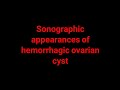 Sonographic appearances of hemorrhagic ovarian cyst