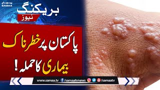 Breaking News! Monkeypox Cases increase In Pakistan | SAMAA TV