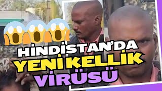 KELLİK VİRÜSÜ Hindistan'da ortaya çıkan yeni #virüs nedeniyle 155 kişi aniden #kel kaldı