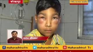 TEACHER IN KOLHAPUR BEATS SCHOOL KID BADLY