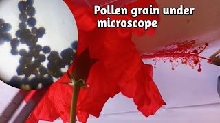 Pollen grains under microscope