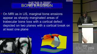 MSK - The hand and wrist 2