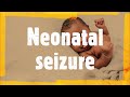 Neonatal Seizures