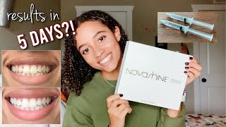 NOVASHINE UNBOXING \u0026 HONEST REVIEW | does it actually work??