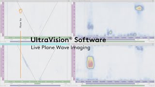 UltraVision® for Live Plane Wave Imaging