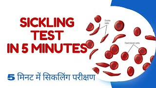 SICKLING TEST IN 5 MINUTES