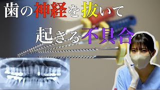 【解説】歯の神経を抜くとどうなるのかを歯科衛生士が解説します