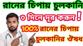 ৩ দিনে দূর করূন রানের চিপায় চুলকানি !রানের চিপায় চুলকানি দূর করার নতুন ক্রিম@cpdrubelmia5966