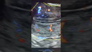 Pregnant होने के लिए Uterus lining कितनी चाहिए | Uterus ki lining कैसे देखते हैं  | Dr Jay Mehta